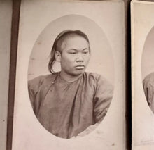 Load image into Gallery viewer, HISTORICALLY IMPORTANT SERIES OF PHOTOS CHINESE LEPERS SAN FRANCISCO 1870S RARE