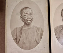 Load image into Gallery viewer, HISTORICALLY IMPORTANT SERIES OF PHOTOS CHINESE LEPERS SAN FRANCISCO 1870S RARE