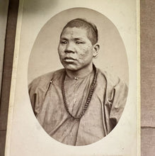 Load image into Gallery viewer, HISTORICALLY IMPORTANT SERIES OF PHOTOS CHINESE LEPERS SAN FRANCISCO 1870S RARE