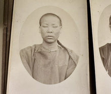 Load image into Gallery viewer, HISTORICALLY IMPORTANT SERIES OF PHOTOS CHINESE LEPERS SAN FRANCISCO 1870S RARE