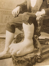 Load image into Gallery viewer, Sideshow Medical & Anatomical Curiosity Eugene Berry "Ohio Big Foot Boy"