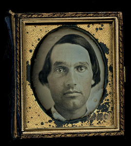 Extreme CLOSE UP Man Face Unusual Daguerreotype Photo 1840s Rare