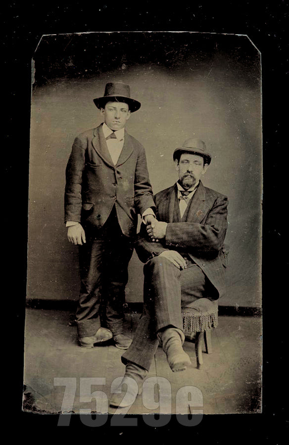 Blind Man + Boy w Clubbed Foot! Friends, Father Son Holding Hands Tintype Photo
