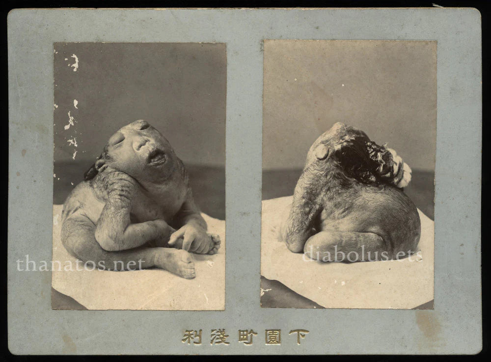 Very Rare Antique Medical Anatomical Photo Japan / Anatomy Oddities