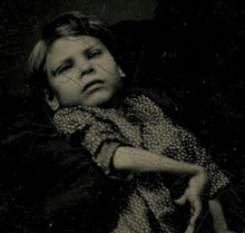 Load image into Gallery viewer, Rare Antique Tintype of a Disabled Child Cerebral Palsy Not Post Mortem

