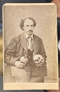 Creepy Man Holding Human Skull 1860s 1870 CDV Photo
