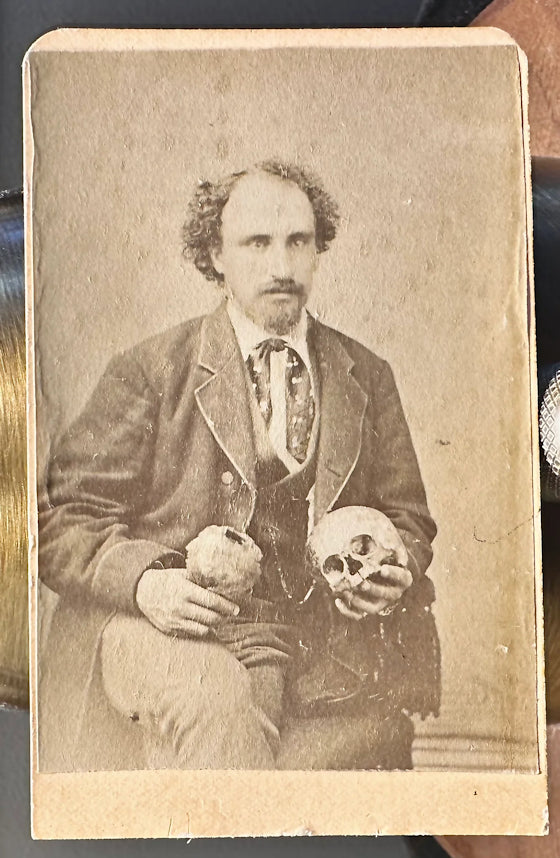Creepy Man Holding Human Skull 1860s 1870 CDV Photo