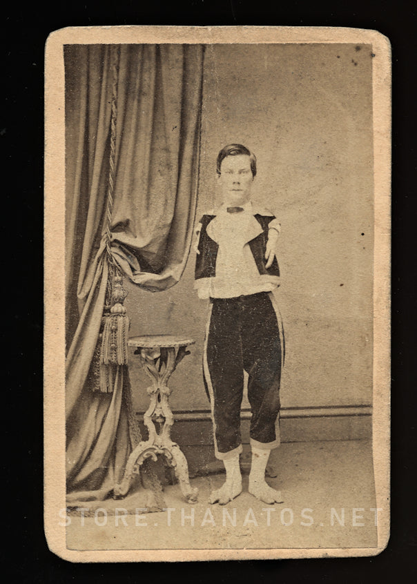 Rare Armless Sideshow Freak Performer - Circa 1870 CDV Photo