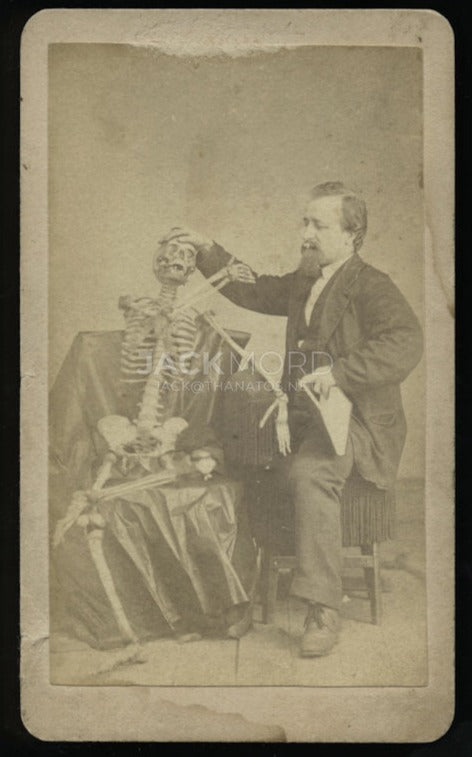Rare CDV Photo Man / Doctor Taking Temperature of Human Skeleton