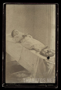 Post Mortem Cabinet Card Child on Cooling Table Ohio