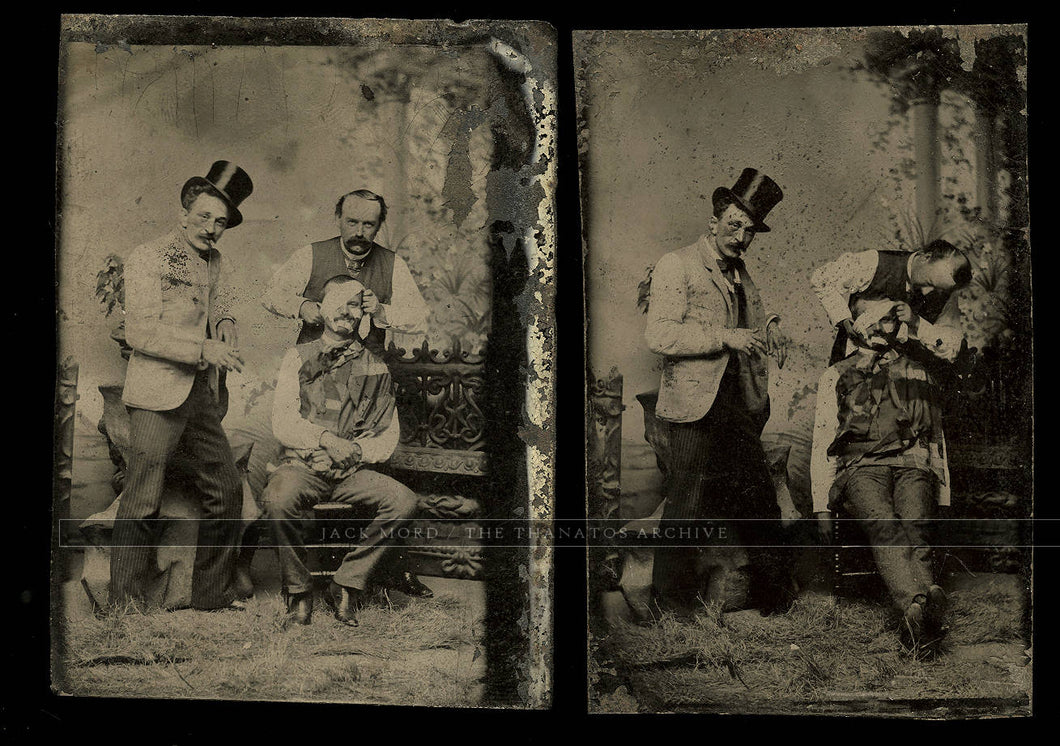 Unusual Antique Tintype Photos Men Bandaging Face of Friend ~ Medical, Oddities