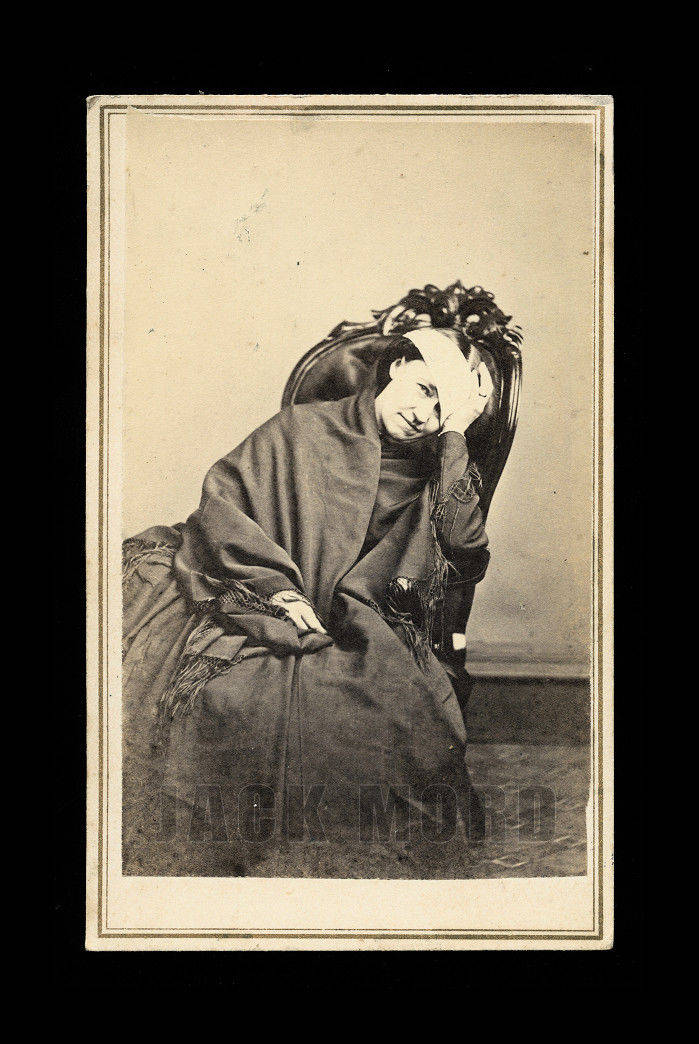 Unusual 1860s CDV Medical Photo - Woman with Bandaged Head! ~ Newton New Jersey