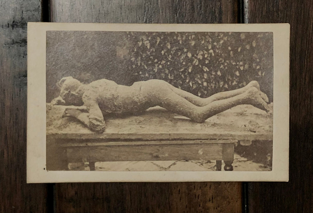 Mount Vesuvius Victim Plaster Cast / 1870s CDV Photo