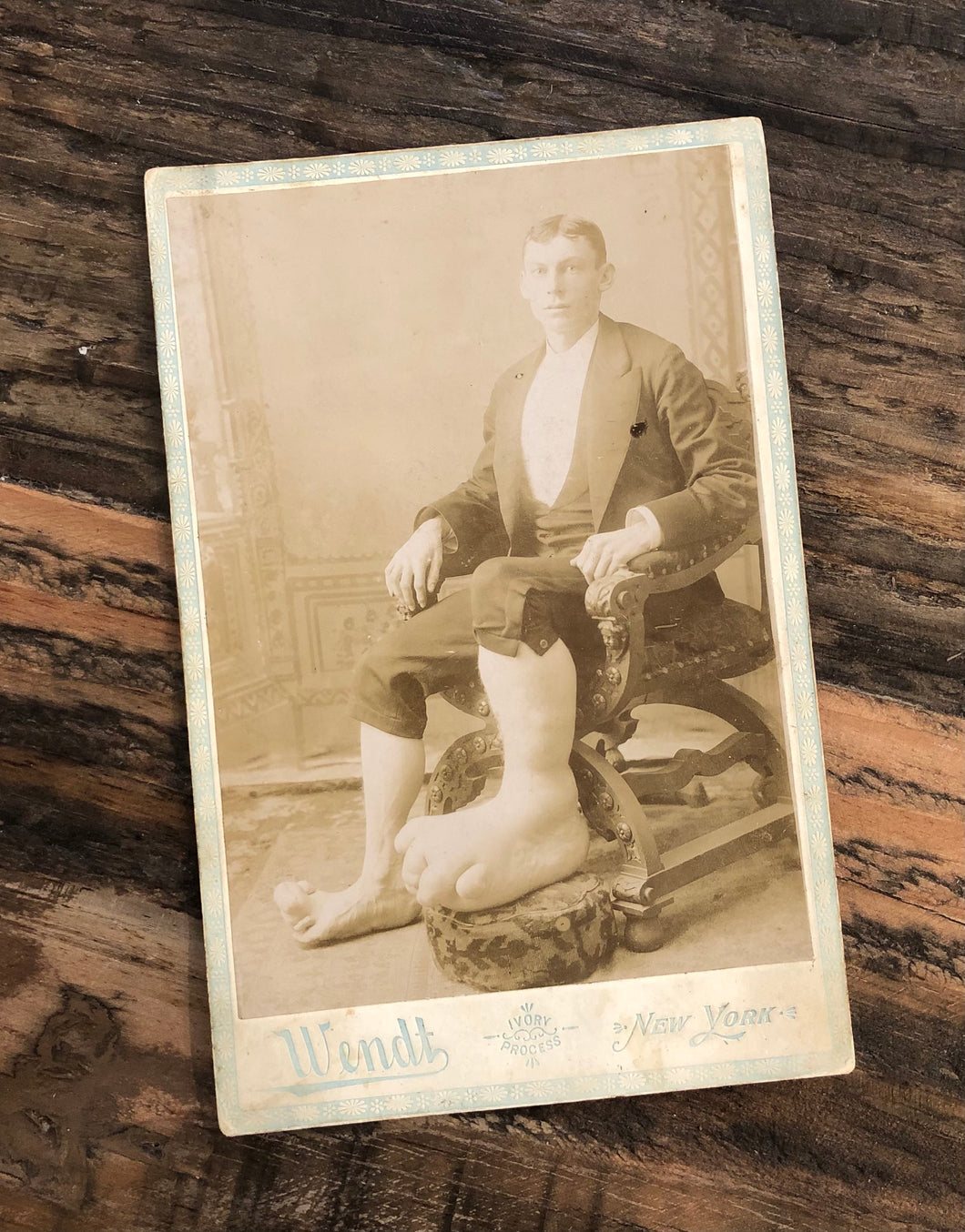 Sideshow Medical & Anatomical Curiosity Eugene Berry 