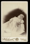 Post Mortem or Dying Baby Open Staring Eyes