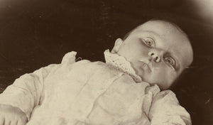 Post Mortem or Dying Baby Open Staring Eyes