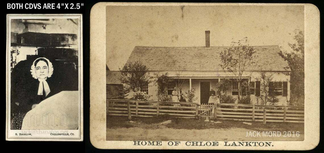 Very Rare CDV Set Bedridden Woman Chloe Lankton - Philadelphia 1860s & 1870s