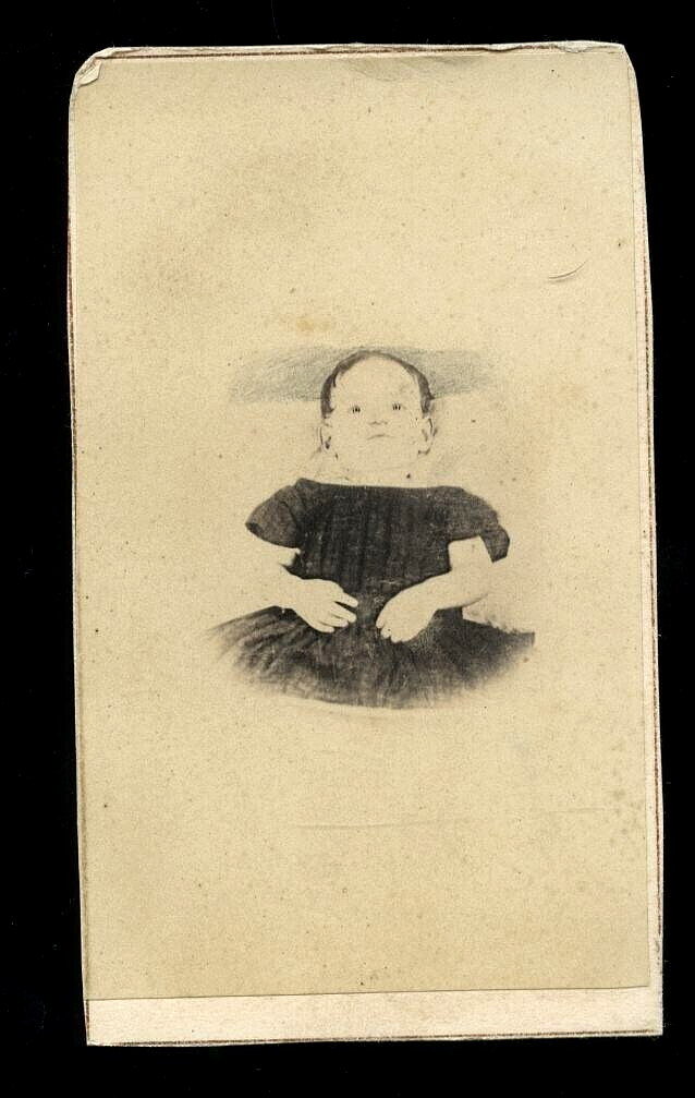 Enhanced 1860s Post Mortem Photo, Little Girl Open Eyes, New Jersey Photographer